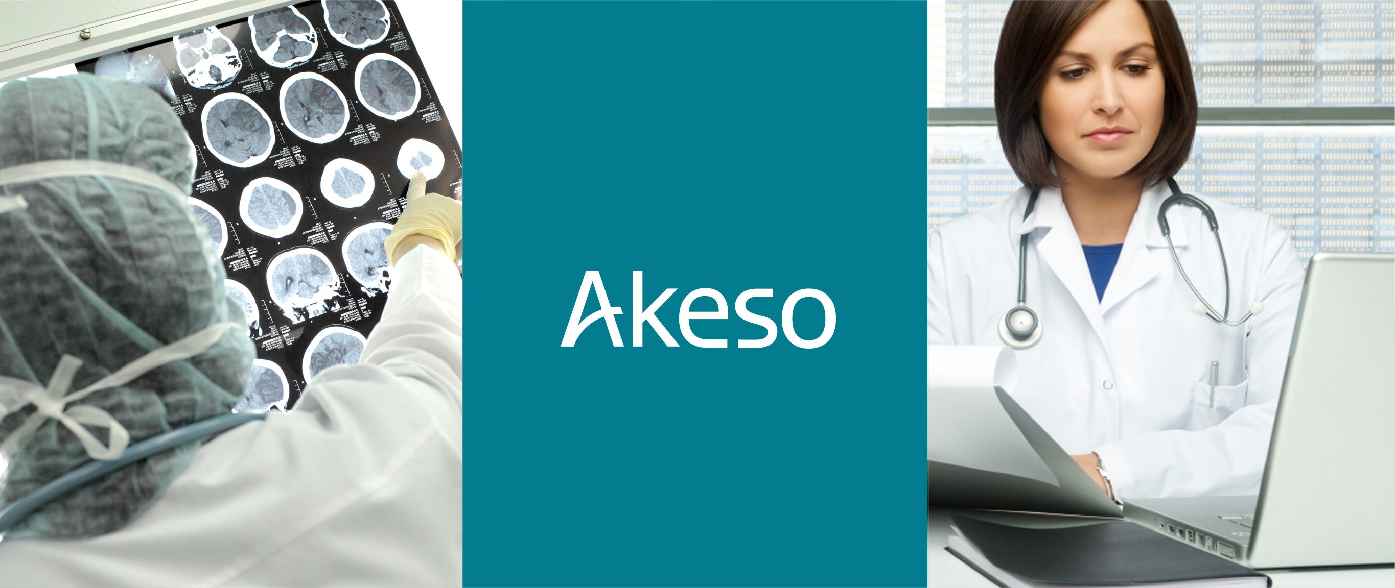 Akeso-3image